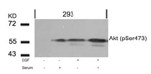 Western Blot analysis of extracts from 293 cells untreated or treated with EGF, Serum or both using Akt (phospho-Ser473) antibody.