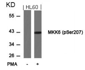 Figure 3. Western blot analysis of extract from HL60 cells untreated or treated with PMA using MKK6 antibody (Lane 1 and 2) and MKK6 (phospho-Ser207) antibody