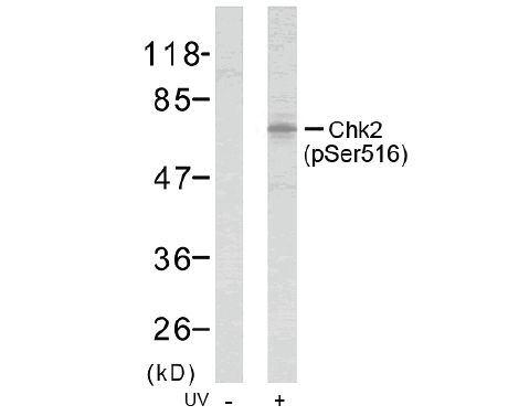 Western blot analysis of extracts from mouse brain using anti-kchip4 rabbit whole antiserum.