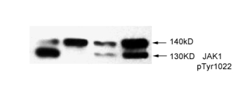 Western blot analysis of extracts from mouse brain using anti-KV4.3 rabbit whole antiserum.