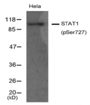 Western blot of rat hippocampal lysate showing specific immunolabeling of the ~25k SNAP25 phosphorylated at Ser 187 (Control). Phosphospecificity is shown in the right lane where the signal is completely eliminated by treatment with lambda phosphatase ( Î» -Ptase, 400 units/100ul lysate for 30 min).