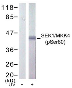 Figure 2. Western blot analysis of extract from 293 cells treated or untreated with UV, using SEK1/ MKK4 (phospho-Ser80) antibody.