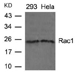 Direct ELISA using Biotin conjugated Rabbit anti-Human TFF-2 antibody
