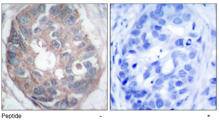 VPS11 antibody staining of paraffin embedded Human Kidney at 3.8ug/ml. Steamed antigen retrieval with citrate buffer pH 6, AP-staining.