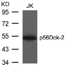 Western Blot analysis of extracts from JK cells using p65Dok-2 antibody