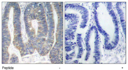 Contactin-4 / Big-2 Antibody (0.5ug/ml) staining of Mouse Olfactory bulb (Lanes 1 and 3) and Cerebral cortex (Lanes 2 and 4), comparing wildtype (lanes 3 and 4) with KO mice (Lanes 1 and 2). The last lane contains a lysate of HEK293 overexpressing Mouse Cntn4 (lysate (35ug protein in RIPA buffer). Primary incubation was 1 hour. Detected by chemiluminescence. Data obtained from Gerrald Lodewijk and Peter Burbach, Rudolf Magnus Institute, Utrecht, Netherlands.