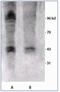 Western blot analysis of Mouse brain extract cells with Rabbit anti-Phosphothreonine Antibody Cat.-No AP03034SU-N. Left: Treated with Vanadium.Right: Non-treated.