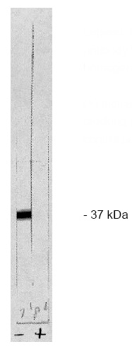 <strong>Immunofluorescent Staining:</strong> Human peripheral blood mononuclear cells were labeled with either Mouse anti-Human CD3 (IgG1) (A), anti-Human CD5 (IgG2a) (B), anti-Human CD22 (IgG2b) (C), anti-Human IgD (IgG3) (D) or anti-Human CD57 (IgM) (E). After washing the cells were then stained with Goat anti-Mouse Ig-R-PE Cat.-No AP32278RP (0.1ug/10<sup>6</sup> cells), following which lymphocytes were gated and analyzed by Flow Cytometry.