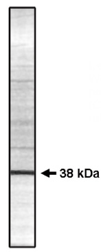 Western blot analysis of extracts from HepG2 cells, using SLC25A21 Antibody The lane on the right is treated with the synthesized peptide.