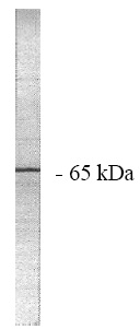 Western blot analysis of extracts from rat heart cells, using NXPH1 Antibody. The lane on the right is treated with the synthesized peptide.