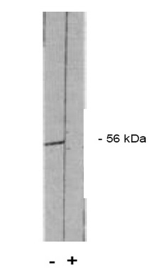 Figure 1. PP2 A/B pan 2 antibody Western blot of total rat brain extract. (+) indicates blocking specific peptide or (-) or control peptide added.