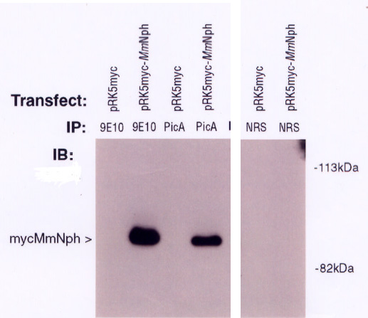 Kidney: Formalin-Fixed Paraffin-Embedded (FFPE)