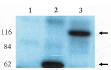 TNNI2 Antibody (0.03ug/ml) staining of Human (A), Mouse (B) and Rat (C) Skeletal Muscle lysate (35ug protein in RIPA buffer). Primary incubation was 1 hour. Detected by chemiluminescence.