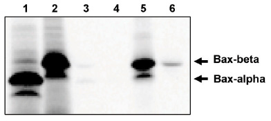 FABP3 Antibody staining of Human (A), Mouse (B) and Rat (C) Heart lysates at 0.01ug/ml (35ug protein in RIPA buffer). Primary incubation was 1 hour. Detected by chemiluminescence.