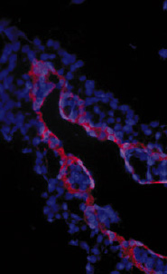 N2a overexpressing Mouse Znrf1 (mock transfection in first lane) and probed with ZNRF1 Antibody (1ug/ml), also staining of Mouse Brain lysates (Embryo E14 and adult cerebellum). Primary incubation was 1 hour. Detected by chemiluminescence.