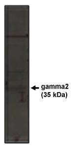 PRKCB Antibody (0.1ug/ml) staining of Human Placenta lysate (35ug protein in RIPA buffer). Primary incubation was 1 hour. Detected by chemiluminescence.
