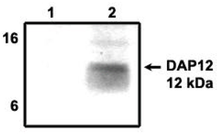 Figure 1. Immunoprecipitation using DAP12 antibody on MHC class I (1) and NKp44 (2) positive cells.