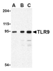 Western blot of rat cortex lysate showing specific immunolabeling of the ~160k adenylate cyclase III protein.