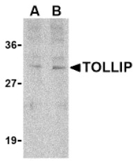 Western blot of rat cortex lysate showing specific immunolabeling of the ~48, 65 &amp; 75kda tau isoforms.