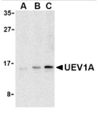 Immunofluorescence staining of a 9 days old Zebrafish embryo.
