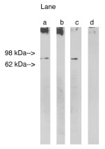 Western blot analysis using Lass 1 at 5 ug/ml on Human Brain lysate 14 ug/lane. Lane A] antibody alone, Lane B] antibody with 45 ug peptide, Lane C] antibody with nonspecific peptide, D]conjugate alone. Visualized using Pierce West Femto substrate system. Anti Rabbit secondary used at 1:3.5K dilution. Exposure for 5 minutes.