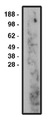 Western blot using nSMase2 antibody on human brain lysate. Lysate used at 14 ug/lane. Antibody used at 10 ug/ml. Secondary antibody, mouse anti-rabbit HRP, used at 1:50k dilution.
