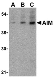 Western blot analysis of human lymph node lysate probed with Rabbit anti Human CD5L, also known as AIM (AP05584PU-N) at 1 (A), 2 (B) and 4 (C) g/ml