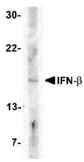 (0.1ug/ml) staining of HEK293 (A) and HeLa (B) lysates (35ug protein in RIPA buffer). Primary incubation was 1 hour. Detected by chemiluminescence