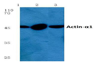 Western blot analysis using alpha skeletal muscle Actin / ACTA1 antibody at 1/500 dilution. Lane 1 : A549 whole cell lysate. Lane 2: SP2/0 whole cell lysate. Lane 3: Rat kidney tissue lysate.