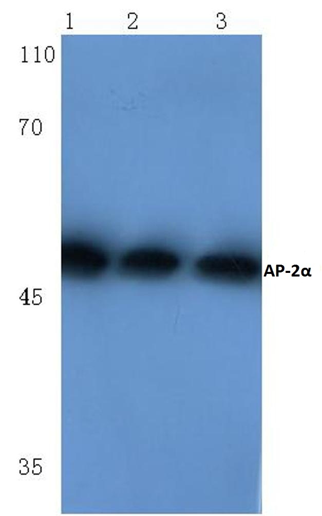 Western blot (WB) analysis of TFAP2A antibody at 1/500 dilution Lane 1:Hela cell lysate Lane 2:Mouse brain tissue lysate Lane 3:Rat kidney tissue lysate