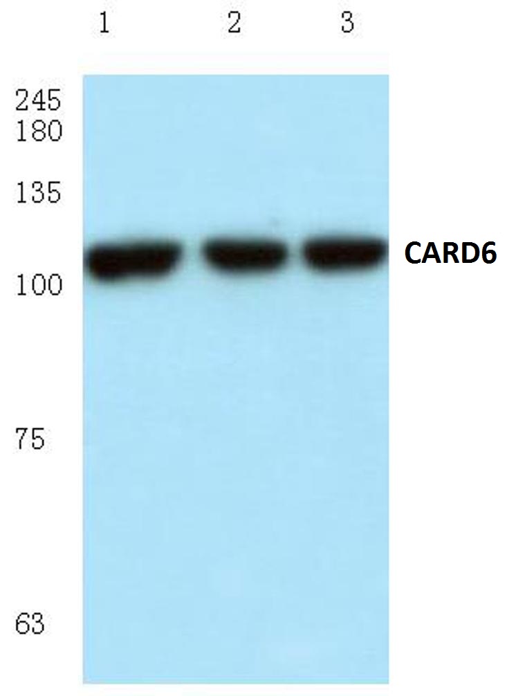 Western blot (WB) analysis of CARD6/CINCIN1 antibody in extracts from HeLa cells.