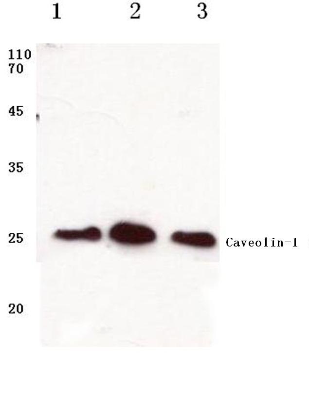 Western blot (WB) analysis of Caveolin-1 antibody at 1/500 dilution Lane 1:A549 cell lysate Lane 2:Mouse brain tissue lysate Lane 3:Rat kidney tissue lysate