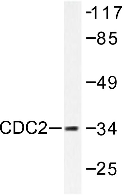 Western blot analysis of extracts from A2780 using CDK1 / CDC2 antibody.