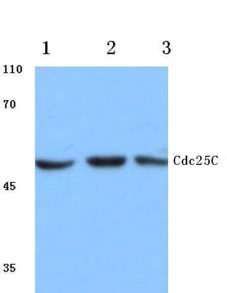 Western blot (WB) analysis of Cdc25C antibody at 1/500 dilution Lane 1:MCF-7 cell lysate Lane 2:Mouse kidney tissue lysate Lane 3:Rat heart tissue lysate