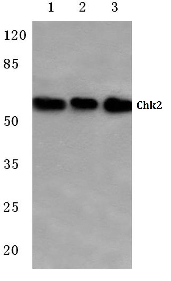 Western blot (WB) analysis of Chk2 antibody at 1/500 dilution Lane 1:Hela cell lysate Lane 2:Mouse liver tissue lysate Lane 3:Rat spleen tissue lysate