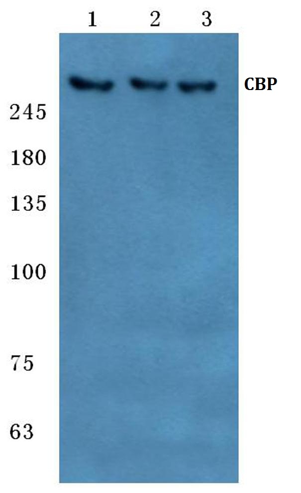 Western blot (WB) analysis of CBP antibody at 1/500 dilution Lane 1:Hela cell lysate Lane 2:Mouse spleen tissue lysate Lane 3:Rat liver tissue lysate