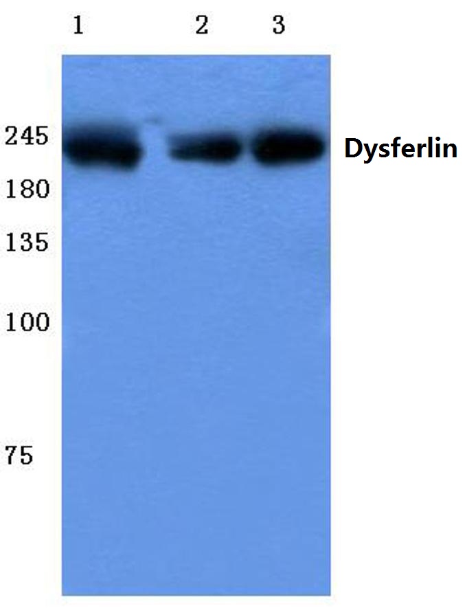 Western blot (WB) analysis of Dysferlin antibody (Cat.-No.: AP06090PU-N) at 1/500 dilution Lane 1:MCF-7 cell lysate Lane 2:sp2/0 cell lysate Lane 3:Rat liver tissue lysate