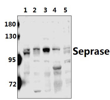 Western blot (WB) analysis of Seprase (K366) pAb at 1:500 dilution.Lane 1:U-251MG lysate (40ug);Lane 2:U-87MG;lysate (40ug);Lane 3:C6 lysate (40ug);Lane 4:MEF