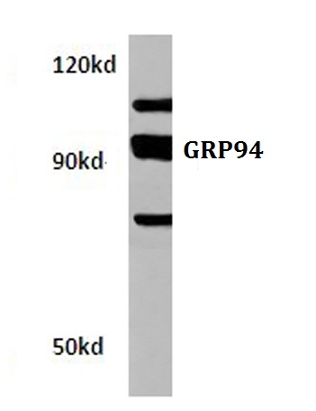 Western blot (WB) analysis of GRP94 antibody in extracts from hela cells.