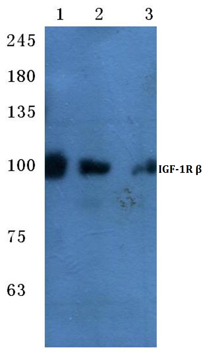 Western blot (WB) analysis of IGF-1R antibody at 1/500 dilution Lane 1:Hela whole cell lysate Lane 2:Mouse brain tissue lysate Lane 3:Rat brain tissue lysate