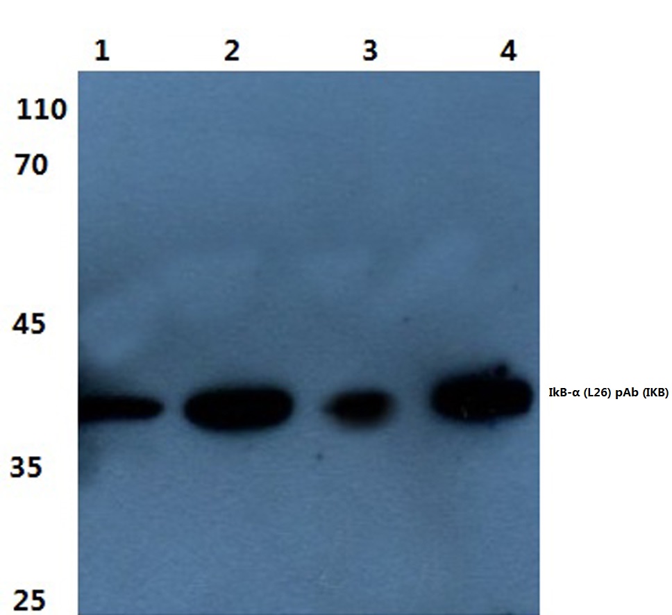 Western blot (WB) analysis of IkB-a antibody at 1/500 dilution Lane 1:Hela whole cell lysate treated with TNF-alpha Lane 2:HepG2 whole cell lysate treated with TNF-alpha Lane 3:RAW264.7 whole cell lysate treated TNF-alpha Lane 4:RAW264.7 whole cell lysate treated with Lps