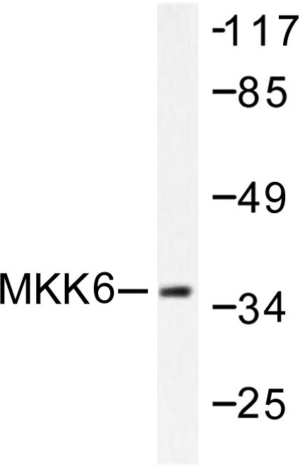 Western blot (WB) analysis of MKK6 antibody in extracts from MDA-MB-435 cells.