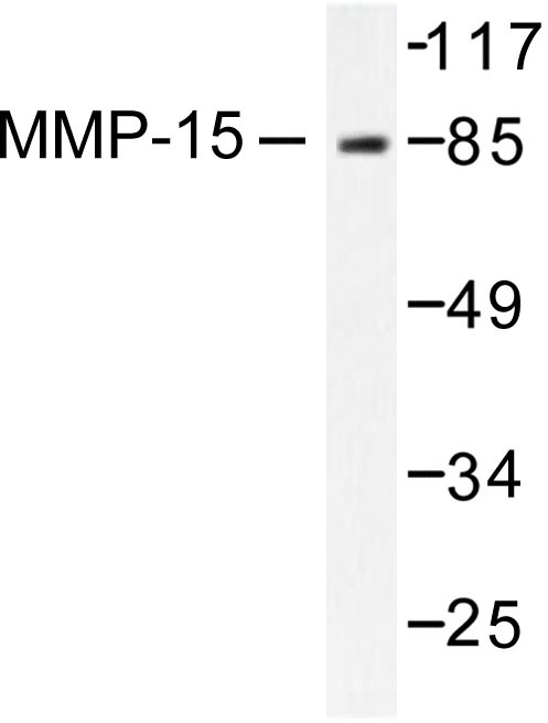 Western blot (WB) analysis of MMP-15 antibody in extracts from MDA-MB-435 cells.