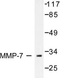 Western blot analysis of MMP-7/2 antibody in extracts from COS7 cells.