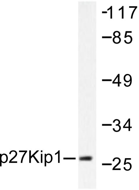 Western blot (WB) analysis of p27 Kip1 antibody in extracts from A2780 cells