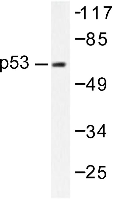 Western blot (WB) analysis of p53 Antibodyin extracts from 293 cell treated with UV.