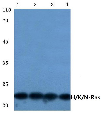 Western blot (WB) analysis of Ras antibody (Cat.-No.: AP06301PU-N) at 1/500 dilution <span style=text-decoration: underline;>Lane 1</span>:HEK293T whole cell lysate <span style=text-decoration: underline;>Lane 2</span>:Hela wh