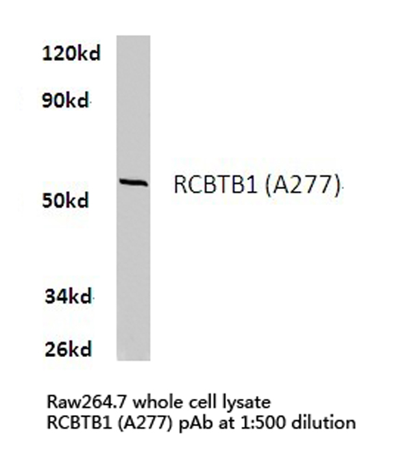 Western blot (WB) analysis of RCBTB1 antibody in extracts from raw264.7 cells.