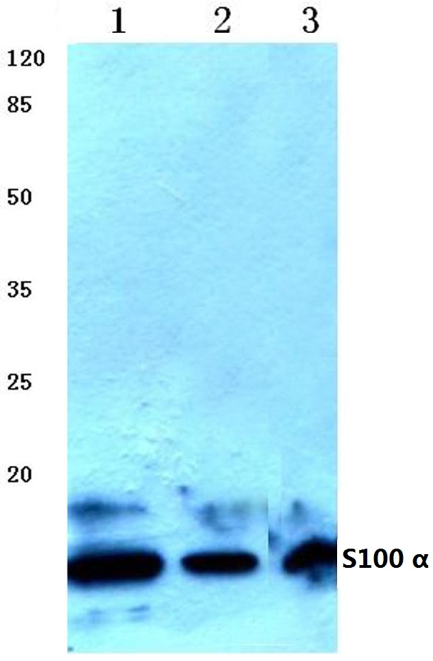 Western blot (WB) analysis of S100 a antibody at 1/500 dilution Lane 1:HEK293T whole cell lysate Lane 2:Mouse brain tissue lysate Lane 3:Rat brain tissue lysate