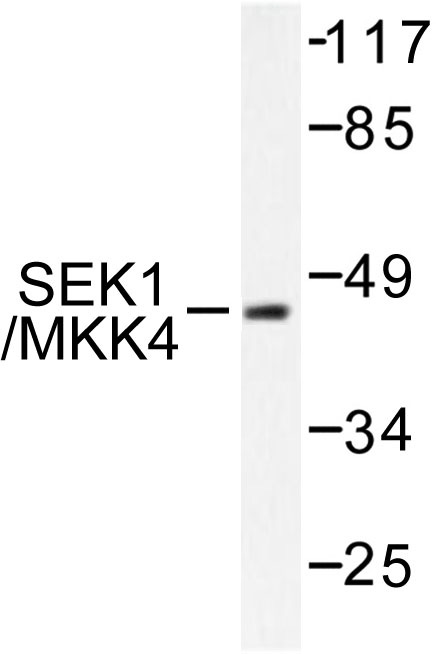 Western blot (WB) analysis of SEK1/MKK4 antibody in extracts from NIH/3T3 cells.
